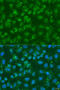 Diacylglycerol Kinase Epsilon antibody, 23-157, ProSci, Immunofluorescence image 