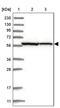 Zinc Finger Protein 354C antibody, PA5-56587, Invitrogen Antibodies, Western Blot image 