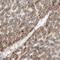 Hepsin antibody, NBP1-86931, Novus Biologicals, Immunohistochemistry paraffin image 
