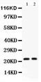 Interleukin-18 antibody, PA2037, Boster Biological Technology, Western Blot image 