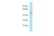 Cyclin Dependent Kinase 8 antibody, PA5-68500, Invitrogen Antibodies, Western Blot image 