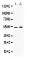 Alpha-1-antitrypsin antibody, PB10097, Boster Biological Technology, Western Blot image 