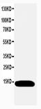 ATP Synthase Peripheral Stalk Subunit F6 antibody, PA1012, Boster Biological Technology, Western Blot image 