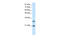 Msh Homeobox 2 antibody, 28-805, ProSci, Western Blot image 