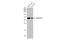 Arginase 1 antibody, GTX113131, GeneTex, Western Blot image 
