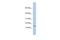 BTG Anti-Proliferation Factor 2 antibody, A01461, Boster Biological Technology, Western Blot image 