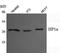 Chromobox 5 antibody, A02780, Boster Biological Technology, Western Blot image 