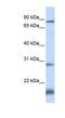 SET And MYND Domain Containing 4 antibody, NBP1-79406, Novus Biologicals, Western Blot image 