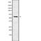 Cholinergic Receptor Nicotinic Gamma Subunit antibody, PA5-68078, Invitrogen Antibodies, Western Blot image 