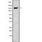 Non-SMC Condensin II Complex Subunit D3 antibody, abx217064, Abbexa, Western Blot image 