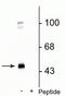 Gamma-Aminobutyric Acid Type A Receptor Gamma2 Subunit antibody, P02361, Boster Biological Technology, Western Blot image 