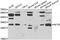 Nuclear Transcription Factor Y Subunit Beta antibody, STJ29434, St John