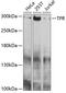 Translocated Promoter Region, Nuclear Basket Protein antibody, 14-160, ProSci, Western Blot image 