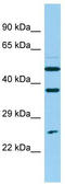 Nudix Hydrolase 14 antibody, TA331572, Origene, Western Blot image 