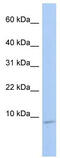 Heat Shock Factor Binding Protein 1 antibody, TA339061, Origene, Western Blot image 