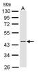 Peroxisome Proliferator Activated Receptor Delta antibody, PA5-29678, Invitrogen Antibodies, Western Blot image 