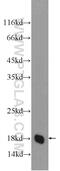 Transmembrane Protein 199 antibody, 25489-1-AP, Proteintech Group, Western Blot image 