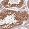 Ubiquitin Protein Ligase E3A antibody, NBP2-38463, Novus Biologicals, Immunohistochemistry paraffin image 