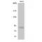 Component Of Inhibitor Of Nuclear Factor Kappa B Kinase Complex antibody, LS-C380733, Lifespan Biosciences, Western Blot image 