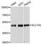 Solute Carrier Family 1 Member 5 antibody, A6981, ABclonal Technology, Western Blot image 