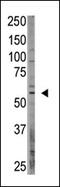 CAMP Responsive Element Binding Protein 3 Like 1 antibody, AP13203PU-N, Origene, Western Blot image 