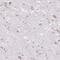 Frizzled Class Receptor 5 antibody, NBP2-49040, Novus Biologicals, Immunohistochemistry frozen image 