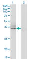 Asialoglycoprotein Receptor 2 antibody, LS-C196698, Lifespan Biosciences, Western Blot image 