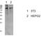 Eukaryotic Translation Elongation Factor 2 antibody, STJ99592, St John