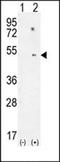 Cyclin-dependent kinase inhibitor 2A, isoform 1 antibody, orb221119, Biorbyt, Western Blot image 