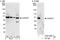 ADP Ribosylation Factor GTPase Activating Protein 1 antibody, A302-029A, Bethyl Labs, Western Blot image 