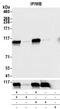 Tripartite Motif Containing 28 antibody, NB100-2350, Novus Biologicals, Immunoprecipitation image 