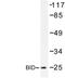 BH3 Interacting Domain Death Agonist antibody, LS-C176658, Lifespan Biosciences, Western Blot image 