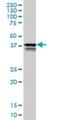 Poly(RC) Binding Protein 2 antibody, H00005094-M02, Novus Biologicals, Western Blot image 