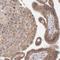 Regulator of nonsense transcripts 3B antibody, NBP1-83134, Novus Biologicals, Immunohistochemistry paraffin image 