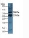 Inducible T Cell Costimulator antibody, MBS2025922, MyBioSource, Western Blot image 