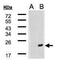 DnaJ Heat Shock Protein Family (Hsp40) Member B9 antibody, PA5-28137, Invitrogen Antibodies, Western Blot image 