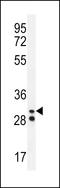 Elastase, Neutrophil Expressed antibody, LS-C164839, Lifespan Biosciences, Western Blot image 