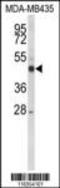 Cytochrome P450 Family 21 Subfamily A Member 2 antibody, 63-264, ProSci, Western Blot image 