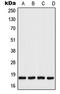 p18 antibody, LS-C352972, Lifespan Biosciences, Western Blot image 