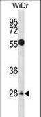 Mediator Complex Subunit 6 antibody, LS-C164125, Lifespan Biosciences, Western Blot image 