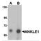 Ankyrin Repeat And LEM Domain Containing 1 antibody, MBS150337, MyBioSource, Western Blot image 