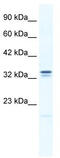 Ankyrin repeat and zinc finger domain-containing protein 1 antibody, TA339505, Origene, Western Blot image 