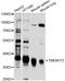 Transmembrane Protein 173 antibody, abx126712, Abbexa, Western Blot image 