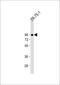 Slingshot Protein Phosphatase 3 antibody, 55-994, ProSci, Western Blot image 