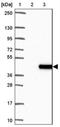 Alcohol Dehydrogenase 5 (Class III), Chi Polypeptide antibody, NBP2-30636, Novus Biologicals, Immunohistochemistry paraffin image 