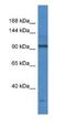 Transcription Termination Factor 1 antibody, NBP1-74129, Novus Biologicals, Western Blot image 