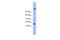 Transmembrane Protein 42 antibody, A19157, Boster Biological Technology, Western Blot image 