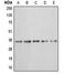 Annexin A3 antibody, LS-C351822, Lifespan Biosciences, Western Blot image 