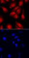 Core-Binding Factor Subunit Beta antibody, AF7349, R&D Systems, Immunocytochemistry image 