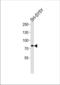 Origin Recognition Complex Subunit 3 antibody, TA324578, Origene, Western Blot image 